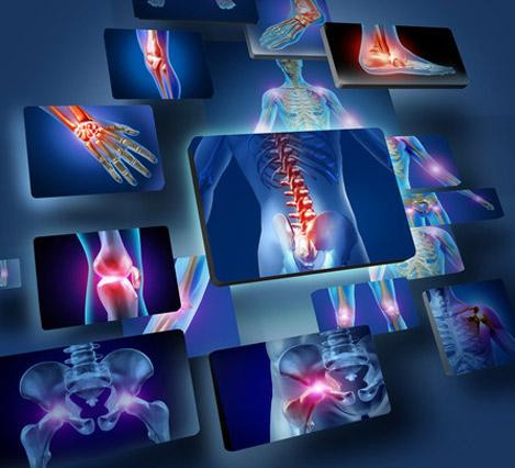 Osteoporosis