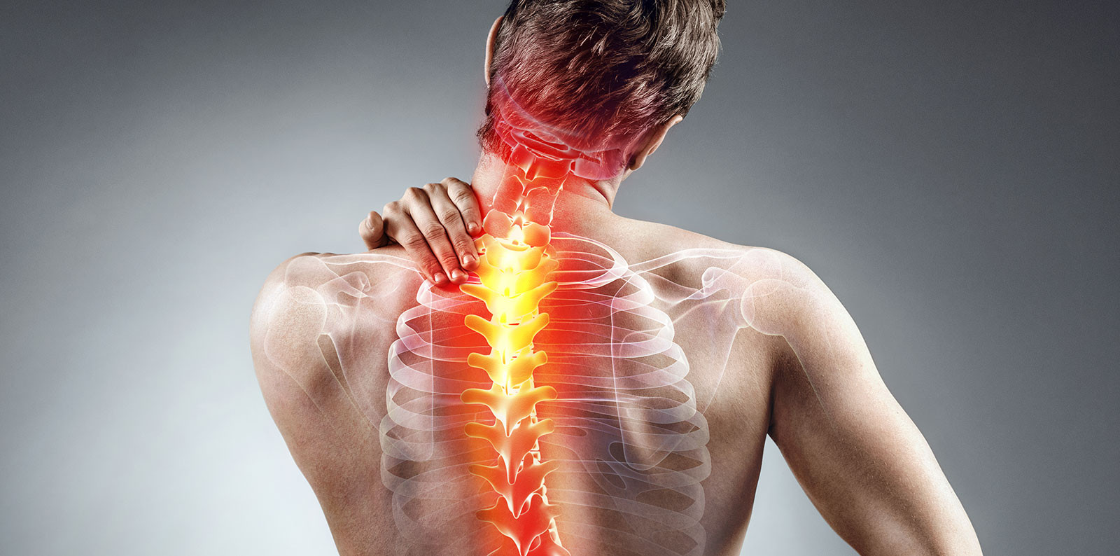 Ankylosing spondylitis