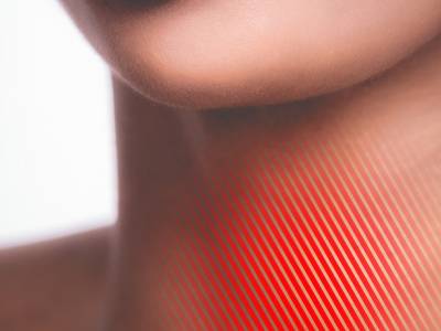 Thyroid Dysfunction