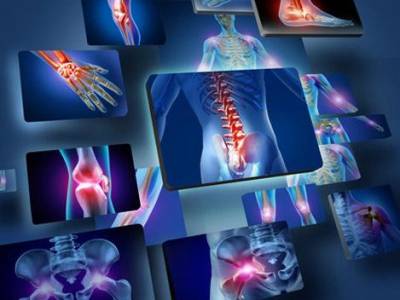 Osteoporosis