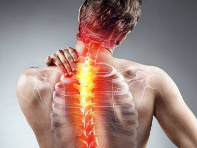 Ankylosing spondylitis