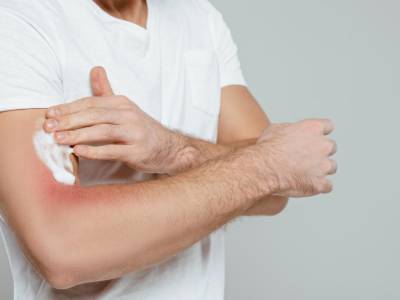 Dermatitis